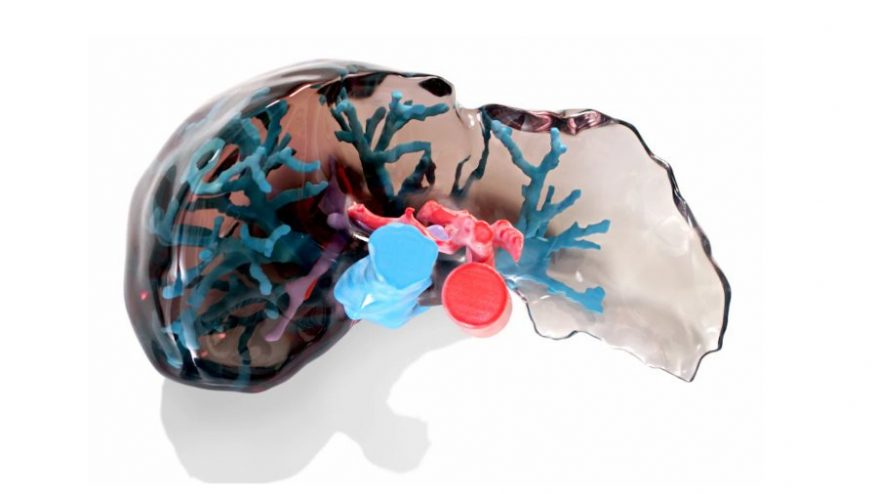 3d printed liver