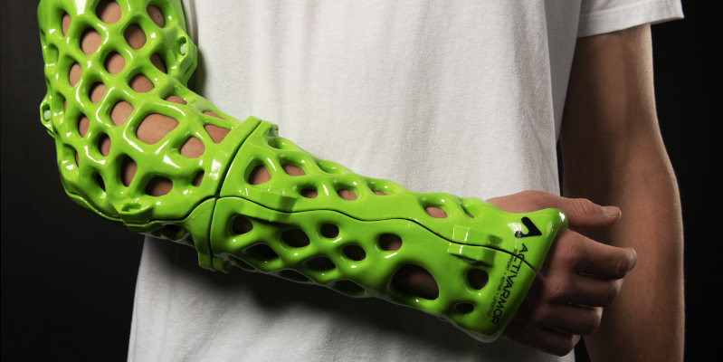 An ActiveArmor 3D printed orthotic arm cast