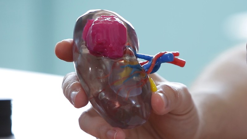 A 3D printed kidney from the University of Bordeaux