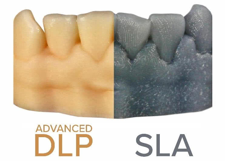 sla vs dlp print quality comparison