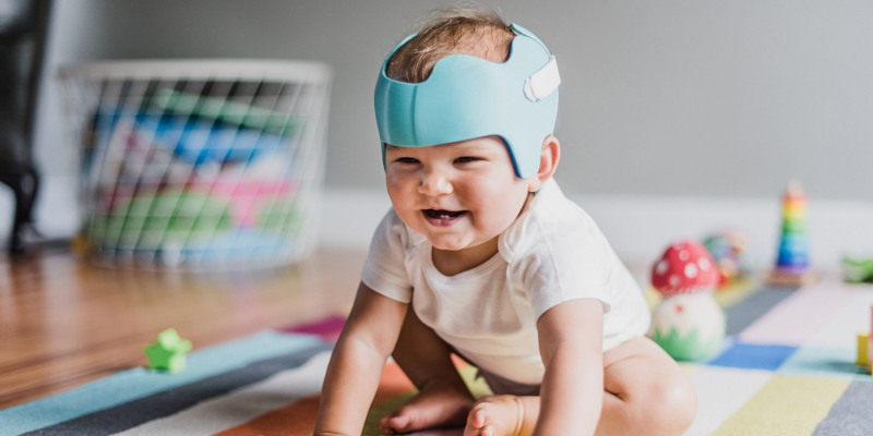 A toddler wearing a 3D printed orthotic helmet