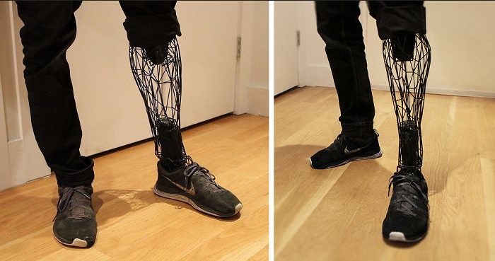 3D printed prosthetics